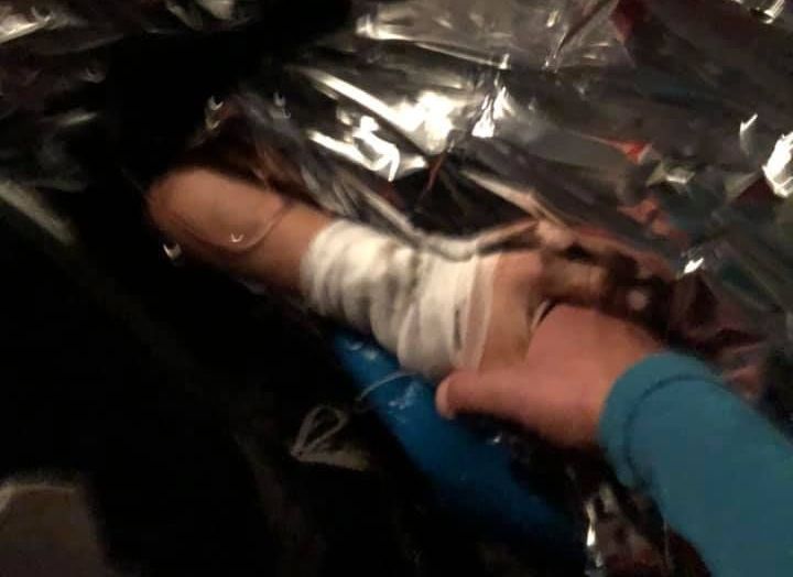 "Зараз стоїть питання про виживання": чоловік однієї із постраждалих під час вибуху на Рахівщині, розповів у якому стані зараз його дружина (ФОТО)