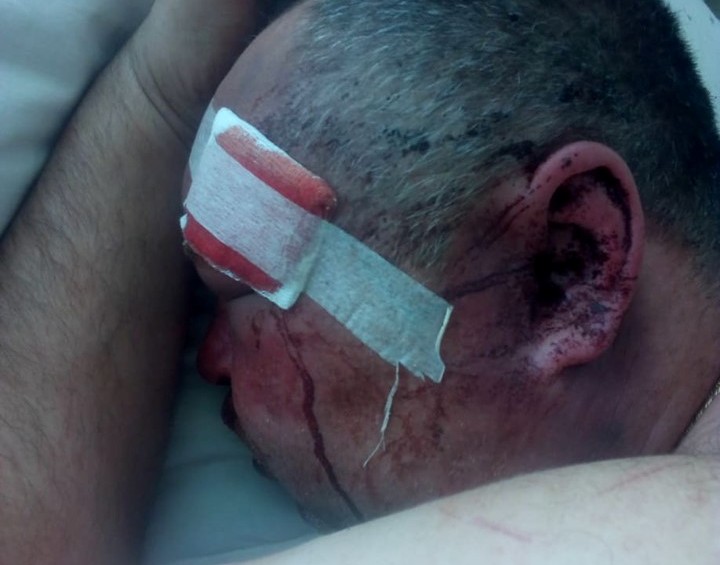 На Закарпатті жорстоко побили людину  (ФОТО)