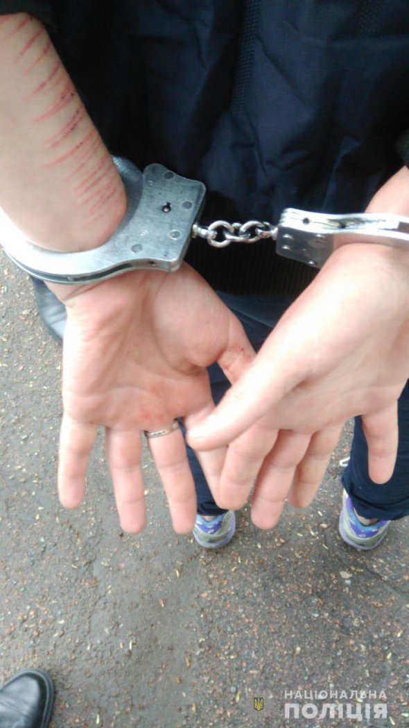 Виник раптовий конфлікт: студент влаштував різанину в гуртожитку (ФОТО)