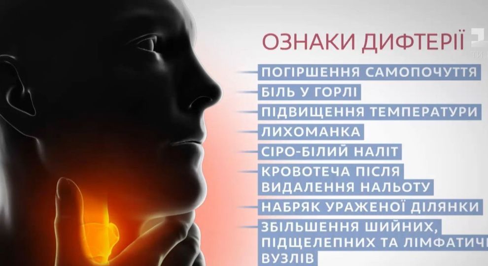 Як розпізнати симптоми дифтерії