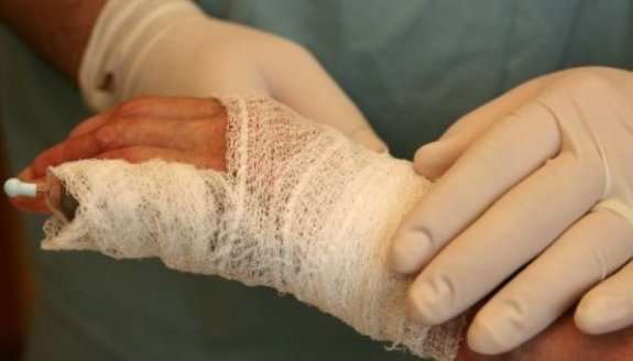 Необережне поводження з вогнем: 80- річний закарпатець у реанімації