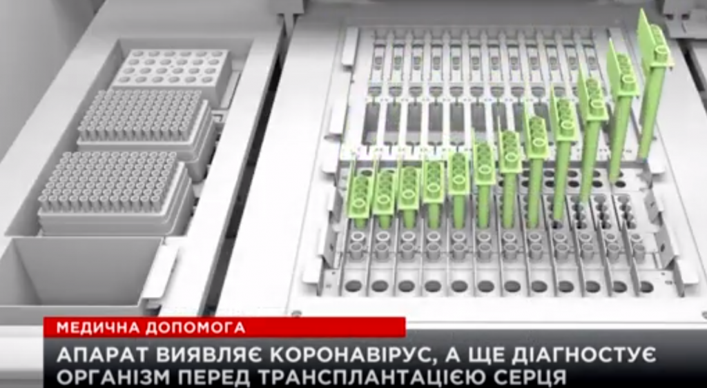 Фонд Оксани Марченко та Віктор Медведчук передали лікарні унікальну тест-систему для виявлення коронавірусу - єдину в Україні (ВІДЕО)