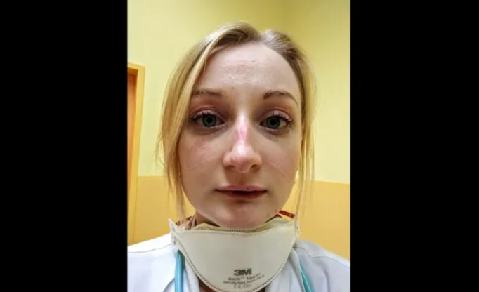 "Я більше не можу. Ми не спимо, не їмо, не пам’ятаю, коли була в туалеті" - крик душі лікарки з Чехії