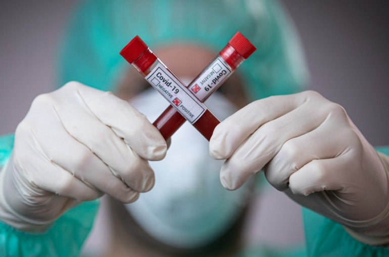 У селі на Мукачівщині виявили COVID-19 - ще один випадок