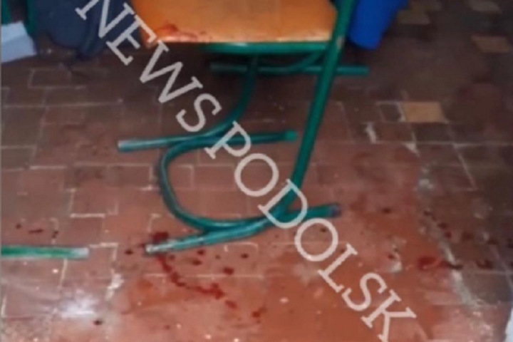 Школяр втратив палець на уроці під час вибуху петарди (ВІДЕО)